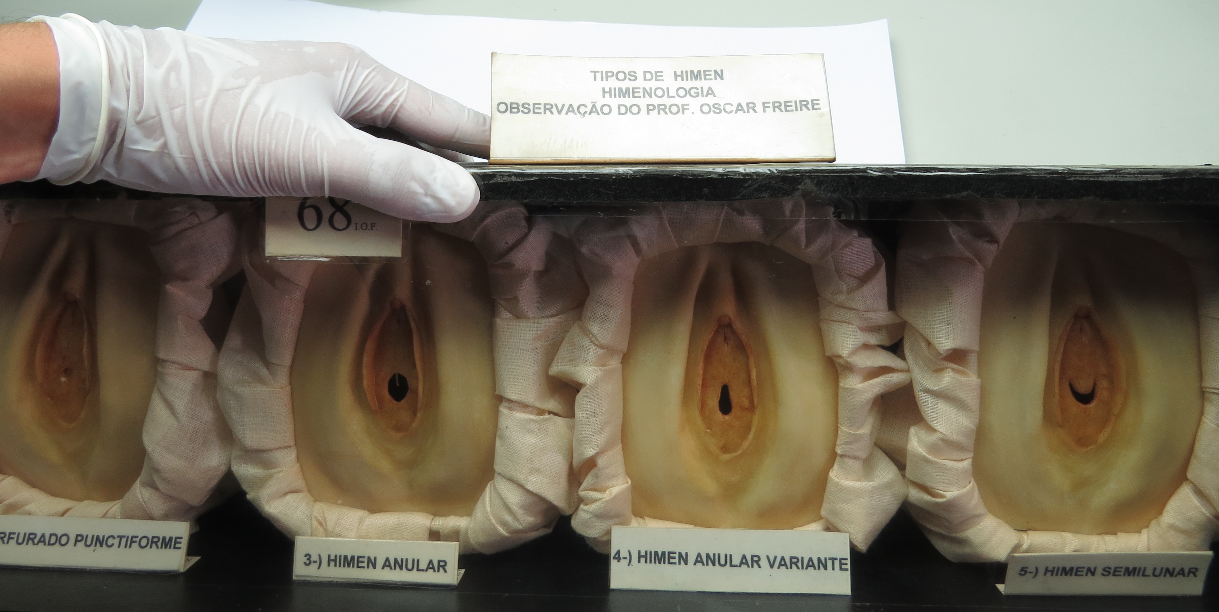 “Escultura de Cera n°68 – Tipos de Hímen. Observação do professor Oscar Freire.” “Escultura de Cera n°68 – Tipos de Hímen. Observação do professor Oscar Freire.”